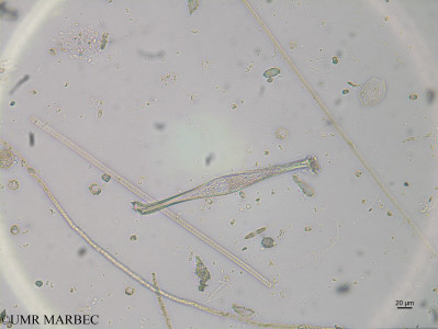 phyto/Brazilian_Nordeste/FernandodeNoronha_station42/ABRACOS2 April 2017/Amphisolenia globifera (st42_SUP_amphisolenia170823_002_ovl)(copy)_thumb.jpg